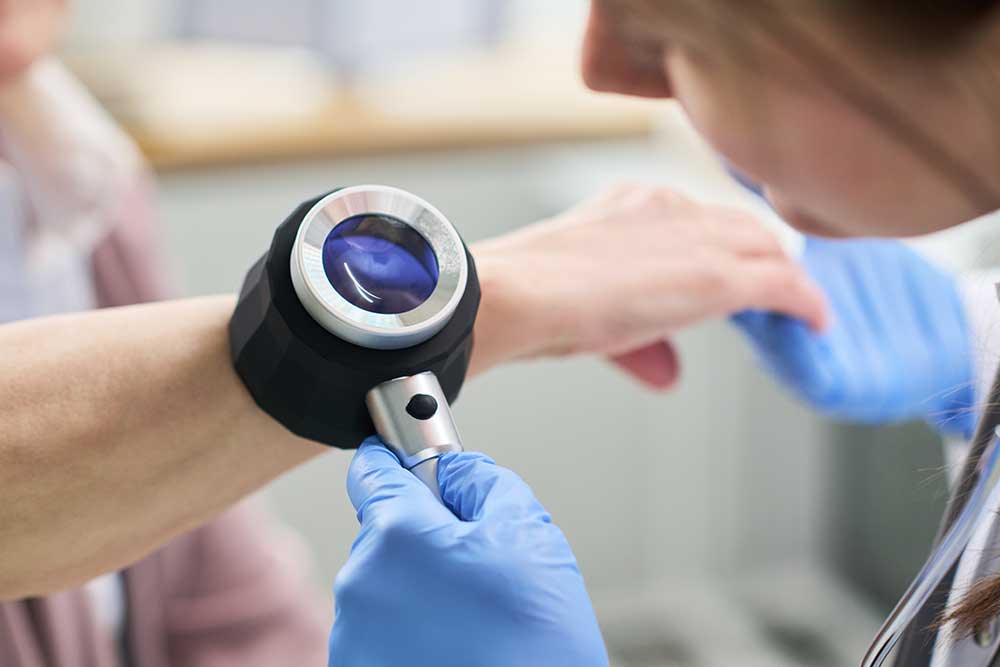 Person getting their skin checked for early signs of skin cancer